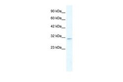 Invitrogen CLIC2 Polyclonal Antibody 100 &mu;L; Unconjugated:Antibodies,