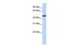Invitrogen GABRR2 Polyclonal Antibody 100 &mu;L; Unconjugated:Antibodies,