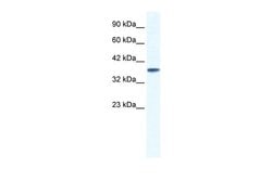 Invitrogen KCNK3 Polyclonal Antibody 100 &mu;L; Unconjugated:Antibodies,
