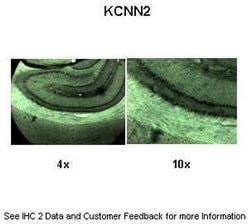 Invitrogen KCNN2 Polyclonal Antibody 100 &mu;L; Unconjugated:Antibodies,