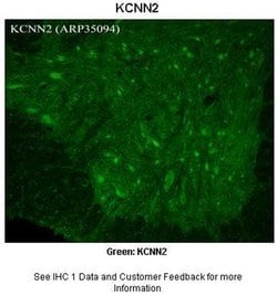 Invitrogen KCNN2 Polyclonal Antibody 100 &mu;L; Unconjugated:Antibodies,