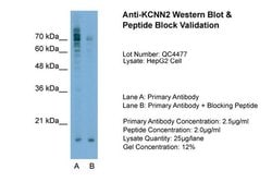 Invitrogen KCNN2 Polyclonal Antibody 100 &mu;L; Unconjugated:Antibodies,