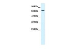 Invitrogen KCNN2 Polyclonal Antibody 100 &mu;L; Unconjugated:Antibodies,