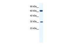 Invitrogen KCNN1 Polyclonal Antibody 100 &mu;L; Unconjugated:Antibodies,