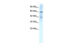 Invitrogen KV4.3 (KCND3) Polyclonal Antibody 100 &mu;L; Unconjugated:Antibodies,