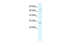 Invitrogen KCNIP1 Polyclonal Antibody 100 &mu;L; Unconjugated:Antikroppar