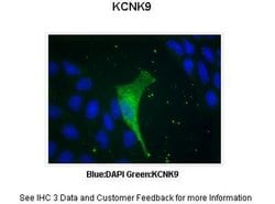 Invitrogen KCNK9 Polyclonal Antibody 100 &mu;L; Unconjugated:Antibodies,