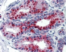 Invitrogen KCNK9 Polyclonal Antibody 100 &mu;L; Unconjugated:Antibodies,