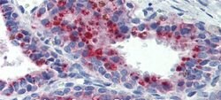 Invitrogen KCNK9 Polyclonal Antibody 100 &mu;L; Unconjugated:Antibodies,