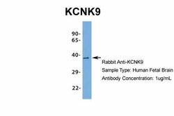 Invitrogen KCNK9 Polyclonal Antibody 100 &mu;L; Unconjugated:Antibodies,