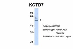 Invitrogen KCTD7 Polyclonal Antibody 100 &mu;L; Unconjugated:Antibodies,
