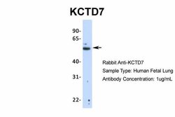 Invitrogen KCTD7 Polyclonal Antibody 100 &mu;L; Unconjugated:Antibodies,