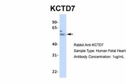 Invitrogen KCTD7 Polyclonal Antibody 100 &mu;L; Unconjugated:Antibodies,