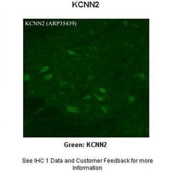 Invitrogen KCNN2 Polyclonal Antibody 100 &mu;L; Unconjugated:Antibodies,