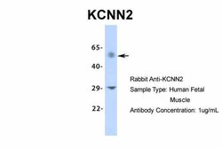 Invitrogen KCNN2 Polyclonal Antibody 100 &mu;L; Unconjugated:Antibodies,