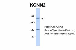 Invitrogen KCNN2 Polyclonal Antibody 100 &mu;L; Unconjugated:Antibodies,