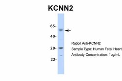 Invitrogen KCNN2 Polyclonal Antibody 100 &mu;L; Unconjugated:Antibodies,