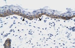 Invitrogen NUDT9 Polyclonal Antibody 100 &mu;L | Buy Online | Invitrogen&trade; | Fisher Scientific