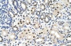 Invitrogen CACNB1 Polyclonal Antibody 100 &mu;L; Unconjugated:Antibodies,