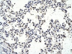 Invitrogen BAF60C Polyclonal Antibody 100 &mu;L; Unconjugated:Antibodies,