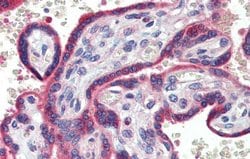 Invitrogen ZNF165 Polyclonal Antibody 100 &mu;L; Unconjugated:Antibodies,