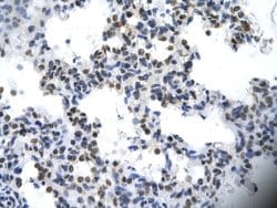 Invitrogen ILF2 Polyclonal Antibody 100 &mu;L; Unconjugated:Antibodies,