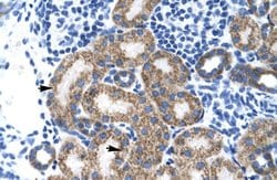 Invitrogen TBPL1 Polyclonal Antibody 100 μL; Unconjugated:Antibodies,