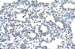 Invitrogen ZRANB2 Polyclonal Antibody 100 &mu;L; Unconjugated:Antibodies,
