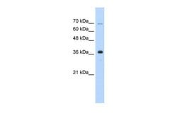 Invitrogen ZRANB2 Polyclonal Antibody 100 &mu;L; Unconjugated:Antibodies,