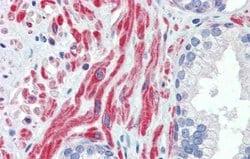 Invitrogen SSX4 Polyclonal Antibody 100 &mu;L; Unconjugated:Antibodies,