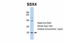Invitrogen SSX4 Polyclonal Antibody 100 &mu;L; Unconjugated:Antibodies,