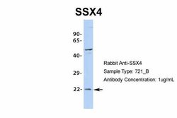 Invitrogen SSX4 Polyclonal Antibody 100 &mu;L; Unconjugated:Antibodies,
