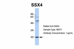 Invitrogen SSX4 Polyclonal Antibody 100 &mu;L; Unconjugated:Antibodies,