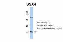 Invitrogen SSX4 Polyclonal Antibody 100 &mu;L; Unconjugated:Antibodies,