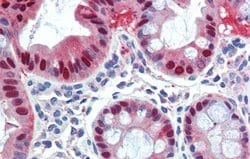Invitrogen SCML1 Polyclonal Antibody 100 μL; Unconjugated:Antibodies,