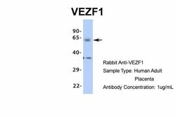 Invitrogen VEZF1 Polyclonal Antibody 100 &mu;L | Buy Online | Invitrogen&trade; | Fisher Scientific