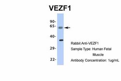 Invitrogen VEZF1 Polyclonal Antibody 100 &mu;L | Buy Online | Invitrogen&trade; | Fisher Scientific