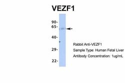 Invitrogen VEZF1 Polyclonal Antibody 100 &mu;L | Buy Online | Invitrogen&trade; | Fisher Scientific