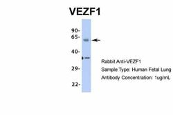 Invitrogen VEZF1 Polyclonal Antibody 100 &mu;L | Buy Online | Invitrogen&trade; | Fisher Scientific