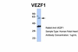 Invitrogen VEZF1 Polyclonal Antibody 100 &mu;L | Buy Online | Invitrogen&trade; | Fisher Scientific
