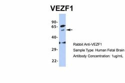 Invitrogen VEZF1 Polyclonal Antibody 100 &mu;L | Buy Online | Invitrogen&trade; | Fisher Scientific