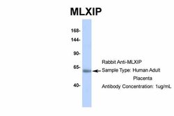 Invitrogen MLXIP Polyclonal Antibody 100 &mu;L; Unconjugated:Anticuerpos