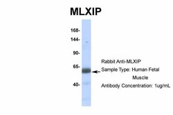 Invitrogen MLXIP Polyclonal Antibody 100 &mu;L; Unconjugated:Anticuerpos