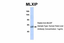 Invitrogen MLXIP Polyclonal Antibody 100 &mu;L; Unconjugated:Anticuerpos