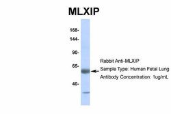 Invitrogen MLXIP Polyclonal Antibody 100 &mu;L; Unconjugated:Anticuerpos