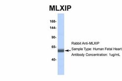 Invitrogen MLXIP Polyclonal Antibody 100 &mu;L; Unconjugated:Anticuerpos