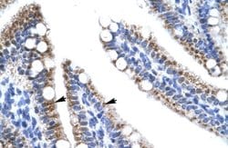 Invitrogen ZNF12 Polyclonal Antibody 100 μL; Unconjugated:Antibodies,