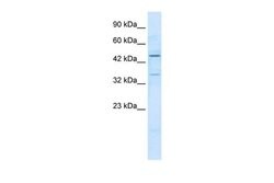 Invitrogen ZNF358 Polyclonal Antibody 100 &mu;L | Buy Online | Invitrogen&trade; | Fisher Scientific