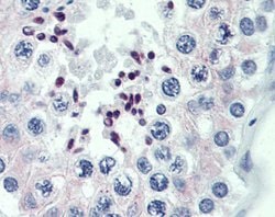 Invitrogen PRDM9 Polyclonal Antibody 100 &mu;L; Unconjugated:Antibodies,