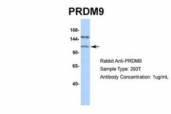 Invitrogen PRDM9 Polyclonal Antibody 100 &mu;L; Unconjugated:Antibodies,